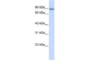 WB Suggested Anti-OTUD7B Antibody Titration:  0. (OTUD7B Antikörper  (Middle Region))