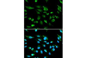 Immunofluorescence analysis of A549 cells using AIRE antibody (ABIN5970888). (AIRE Antikörper)