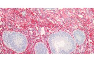 Immunohistochemistry of paraffin-embedded Human endometrium and prostate using COL3A1 Polyclonal Antibody at dilution of 1:100. (COL3A1 Antikörper)