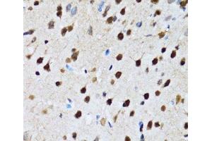 Immunohistochemistry of paraffin-embedded Rat brain using CCAR2 Polyclonal Antibody at dilution of 1:100 (40x lens). (CCAR2 Antikörper)