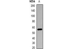 Western blot analysis of Nyctalopin expression in HEK293T (A) whole cell lysates. (Nyctalopin Antikörper)