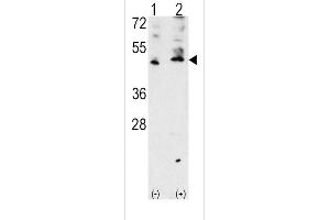 Western blot analysis of VEGF3 Antibody polyclonal antibody using 293 cell lysates (2 ug/lane) either nontransfected (Lane 1) or transiently transfected with the VEGF3 gene (Lane 2). (VEGFC Antikörper  (AA 248-277))
