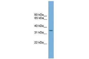 WB Suggested Anti-SLC35A4 Antibody Titration:  0. (SLC35A4 Antikörper  (Middle Region))
