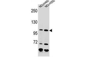 Western blot analysis of Nibrin Antibody (C-term) in NCI-H460, NCI-H292 cell line lysates (35ug/lane).