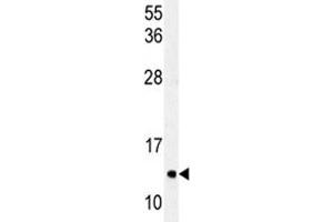 Western blot analysis of LC3C antibody and HeLa lysate (LC3C Antikörper  (AA 27-57))