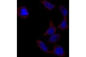 Image no. 2 for anti-POU Class 5 Homeobox 1 (POU5F1) antibody (ABIN357429) (OCT4 Antikörper)