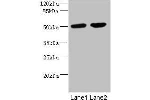 Western blot All lanes: CHRNA10 antibody at 0. (CHRNA1 Antikörper  (AA 25-240))