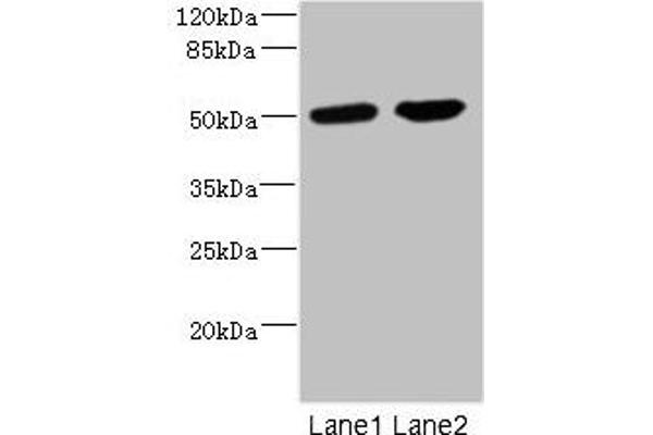 CHRNA1 Antikörper  (AA 25-240)