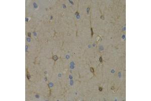 Immunohistochemistry of paraffin-embedded rat brain using WNT3A antibody (ABIN6292349) at dilution of 1:200 (40x lens). (WNT3A Antikörper)