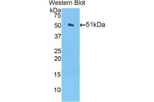 Detection of Recombinant CPT1A, Mouse using Polyclonal Antibody to Carnitine Palmitoyltransferase 1A, Liver (CPT1A)