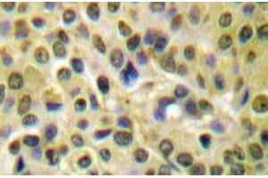 Image no. 1 for anti-V-Akt Murine Thymoma Viral Oncogene Homolog 1 (AKT1) (pSer473) antibody (ABIN317955) (AKT1 Antikörper  (pSer473))