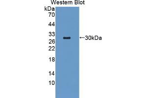 Western blot analysis of the recombinant protein. (TRAF6 Antikörper  (AA 254-475))