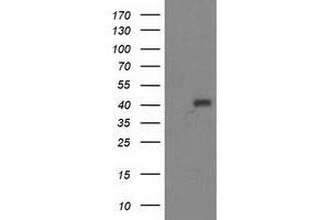 Western Blotting (WB) image for anti-Alcohol Dehydrogenase 1B (Class I), beta Polypeptide (ADH1B) antibody (ABIN1496478) (ADH1B Antikörper)