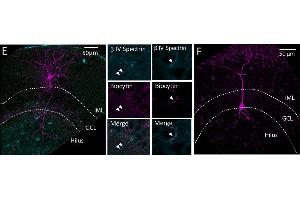 Confocal image stacks of representative Axo-axonic cells (AAC) (E) and Basket Cells (F).