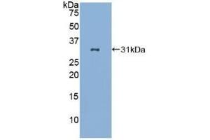 Detection of Recombinant LAB7-2, Human using Polyclonal Antibody to Cluster Of Differentiation 86 (CD86) (CD86 Antikörper  (AA 46-282))