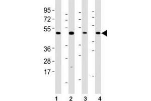 Western blot testing of Mlkl antibody at 1:2000 dilution and mouse samples: (1) lung, (2) NIH3T3, (3) liver, (4) testis lysate; Predicted size: 54 kDa. (MLKL Antikörper  (AA 444-472))