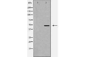 Western blot analysis of GPR103 expression in LOVO cells. (QRFPR Antikörper  (Internal Region))