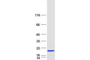Western Blotting (WB) image for Hippocalcin Like 4 (HPCAL4) protein (Myc-DYKDDDDK Tag) (ABIN2722774)