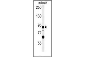 Western blot analysis of LRRC36 Antibody (N-term) in mouse heart tissue lysates (35ug/lane).