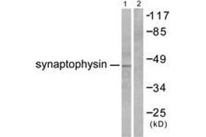 Western blot analysis of extracts from LOVO cells, using Synaptophysin Antibody. (Synaptophysin Antikörper  (AA 101-150))