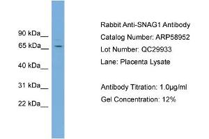 WB Suggested Anti-SNAG1  Antibody Titration: 0.
