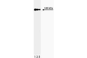 Western blot analysis of Topo IIbeta on a Jurkat lysate. (TOP2B Antikörper  (AA 1281-1494))