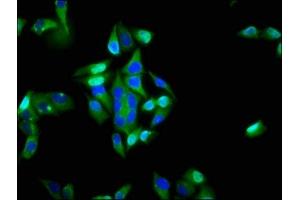 Immunofluorescence staining of Hela cells with ABIN7156446 at 1:200, counter-stained with DAPI. (ITGA6 Antikörper  (AA 625-866))