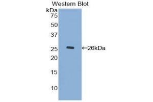 Western Blotting (WB) image for anti-Mucin 17, Cell Surface Associated (MUC17) (AA 3773-3998) antibody (ABIN1078335) (MUC17 Antikörper  (AA 3773-3998))