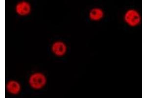 Immunofluorescence (fixed cells) (IF/ICC) image for anti-Ubiquitin-Like with PHD and Ring Finger Domains 2, E3 Ubiquitin Protein Ligase (UHRF2) (Internal Region) antibody (ABIN6265881)