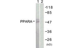 Western blot analysis of extracts from NIH-3T3 cells, using PPAR-alpha (Ab-21) Antibody.