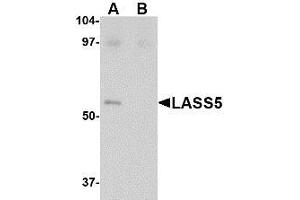 Western blot analysis of LASS5 in SK-N-SH lysate with LASS5 antibody at 1 µg/ml in the (A) absence and (B) presence of blocking peptide.