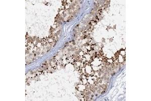 Immunohistochemical staining of human testis with ACRBP polyclonal antibody  shows strong cytoplasmic(acrosomal) positivity in cells of seminiferous ducts. (ACRBP Antikörper)