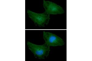 ICC/IF analysis of PRPS1 in HeLa cells line, stained with DAPI (Blue) for nucleus staining and monoclonal anti-human PRPS1 antibody (1:100) with goat anti-mouse IgG-Alexa fluor 488 conjugate (Green). (PRPS1 Antikörper)