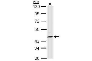 WB Image Sample (30 ug of whole cell lysate) A: Molt-4 , 10% SDS PAGE antibody diluted at 1:10000 (ARFIP2 Antikörper)