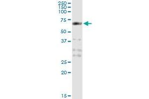 Immunoprecipitation of PCTK1 transfected lysate using mouse monoclonal anti-PCTK1 and Protein A Magnetic Bead (PCTK1 (Human) IP-WB Antibody Pair)