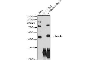 Immunoprecipitation analysis of 300 μg extracts of HeLa cells using 3 μg γ-Tubulin antibody (ABIN7271051). (TUBG1 Antikörper)