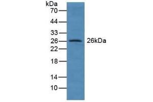 Detection of GSTA4 in Human Lung Tissue using Polyclonal Antibody to Glutathione S Transferase A4 (GSTA4) (GSTA4 Antikörper  (AA 3-222))