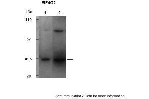 Sample Type: 1. (EIF4G2 Antikörper  (C-Term))