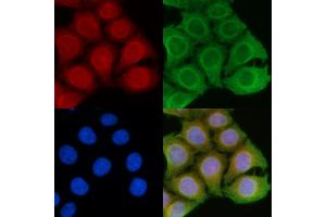 ABIN6258597 and ABIN6274827 staining Hela cells(45 min of heat-shock) by IF/ICC.