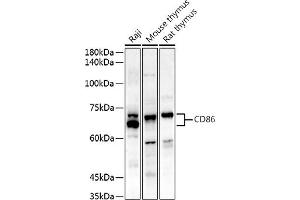 Western blot analysis of extracts of various cell lines, using CD86 antibody (ABIN7266226) at 1:500 dilution. (CD86 Antikörper)