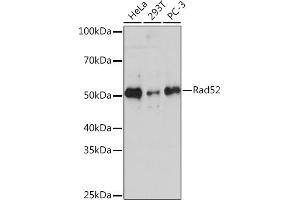 Western blot analysis of extracts of various cell lines, using Rad52 Rabbit mAb (ABIN7269828) at 1:1000 dilution. (RAD52 Antikörper)
