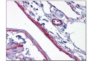 Human Perivascular Processes: Formalin-Fixed, Paraffin-Embedded (FFPE) (SYNPO Antikörper  (C-Term))