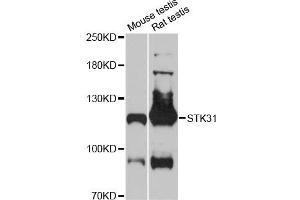 Western blot analysis of extracts of various cell lines, using STK31 antibody (ABIN6293705) at 1:3000 dilution. (STK31 Antikörper)