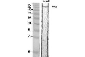 Western Blot (WB) analysis of HepG2 cells using NOS3 Polyclonal Antibody. (ENOS Antikörper  (Thr180))
