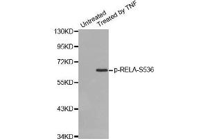 Western blot analysis of extracts from HepG2 cells using Phospho-RELA-S536 antibody. (NF-kB p65 Antikörper  (pSer536))