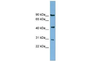 WB Suggested Anti-TUSC4 Antibody Titration:  0.
