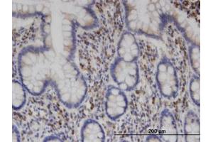 Image no. 2 for anti-Clathrin Interactor 1 (CLINT1) (AA 161-262) antibody (ABIN599495) (CLINT1 Antikörper  (AA 161-262))