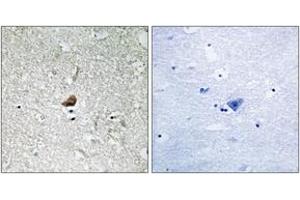 Immunohistochemistry analysis of paraffin-embedded human brain, using IRAK1 (Ab-376) Antibody. (IRAK1 Antikörper  (AA 342-391))