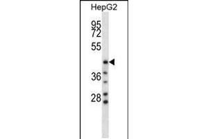 Western blot analysis in HepG2 cell line lysates (35ug/lane). (HYAL1 Antikörper  (C-Term))