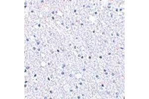 Immunohistochemistry of TIGAR in human brain tissue with this product at 2.